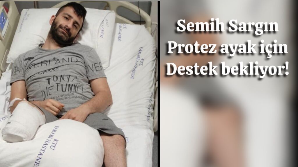 Semih protez ayak bekliyor!